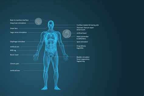 Juxtalayer: Revolutionizing Medical Implants through Tailored Biocompatibility and Enhanced Osseointegration!